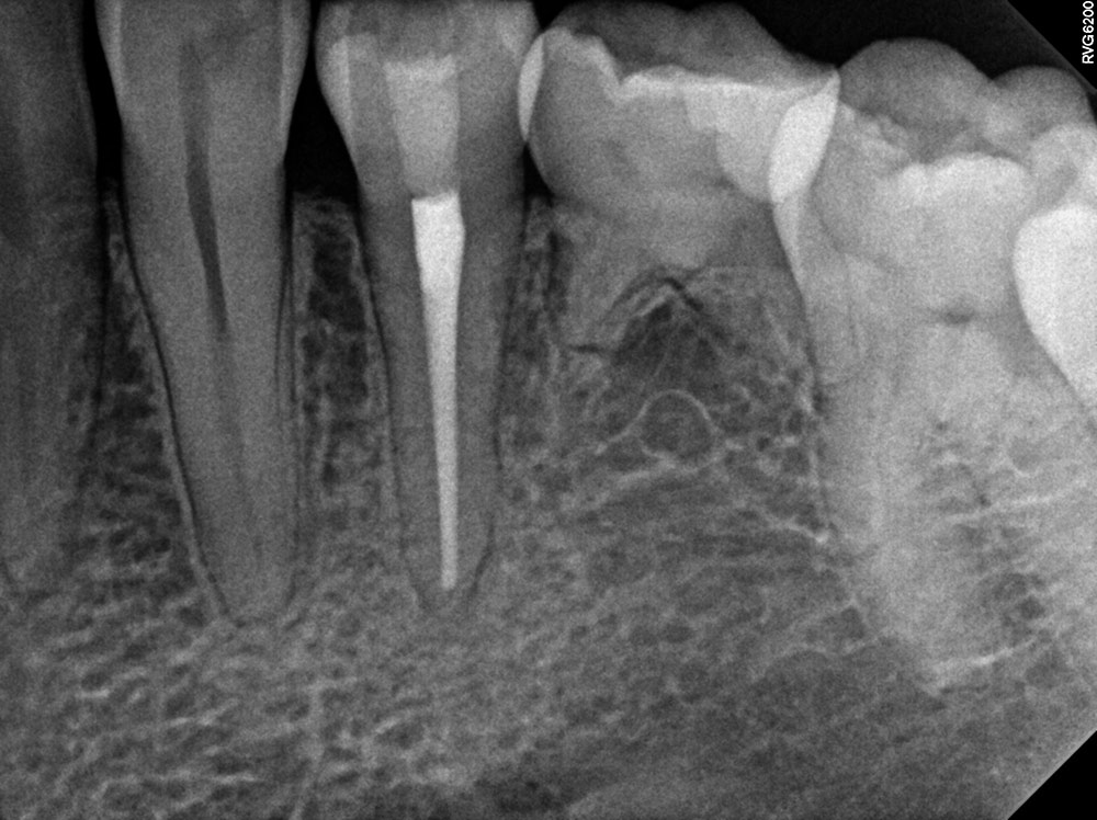 RCT-pic-for-website Woman with dental hygienist receiving dental exam